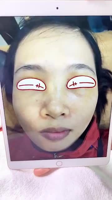 Combo: Phun mày tán bột + Phun môi khử thâm - Đẹp tự nhiên ngay sau khi làm