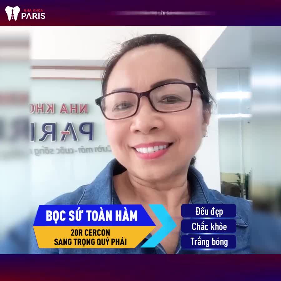 BỌC RĂNG SỨ Thay Đổi Nụ Cười - Gương Mặt Rạng Rỡ Trẻ So Với Tuổi