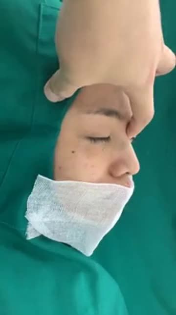 Thế nào là một dáng mũi tự nhiên phù hợp với khuôn mặt