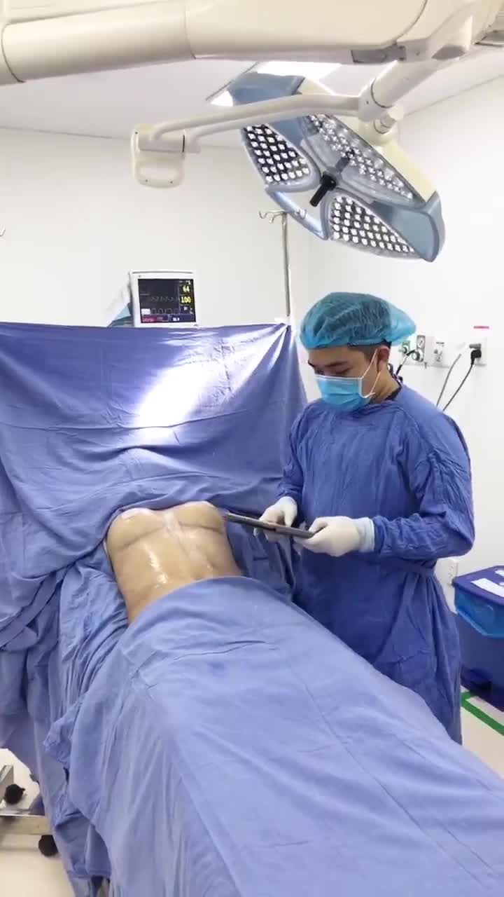 Cải thiện vòng 2 nâng cấp vòng 1 cho khách hàng.