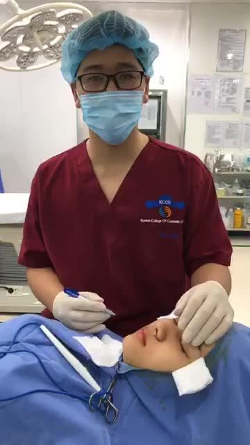 Đo vẽ phân tích Cuộn cánh mũi- cải thiện tình trạng cánh mũi to tại Bệnh Viện Thẩm mỹ Kangnam