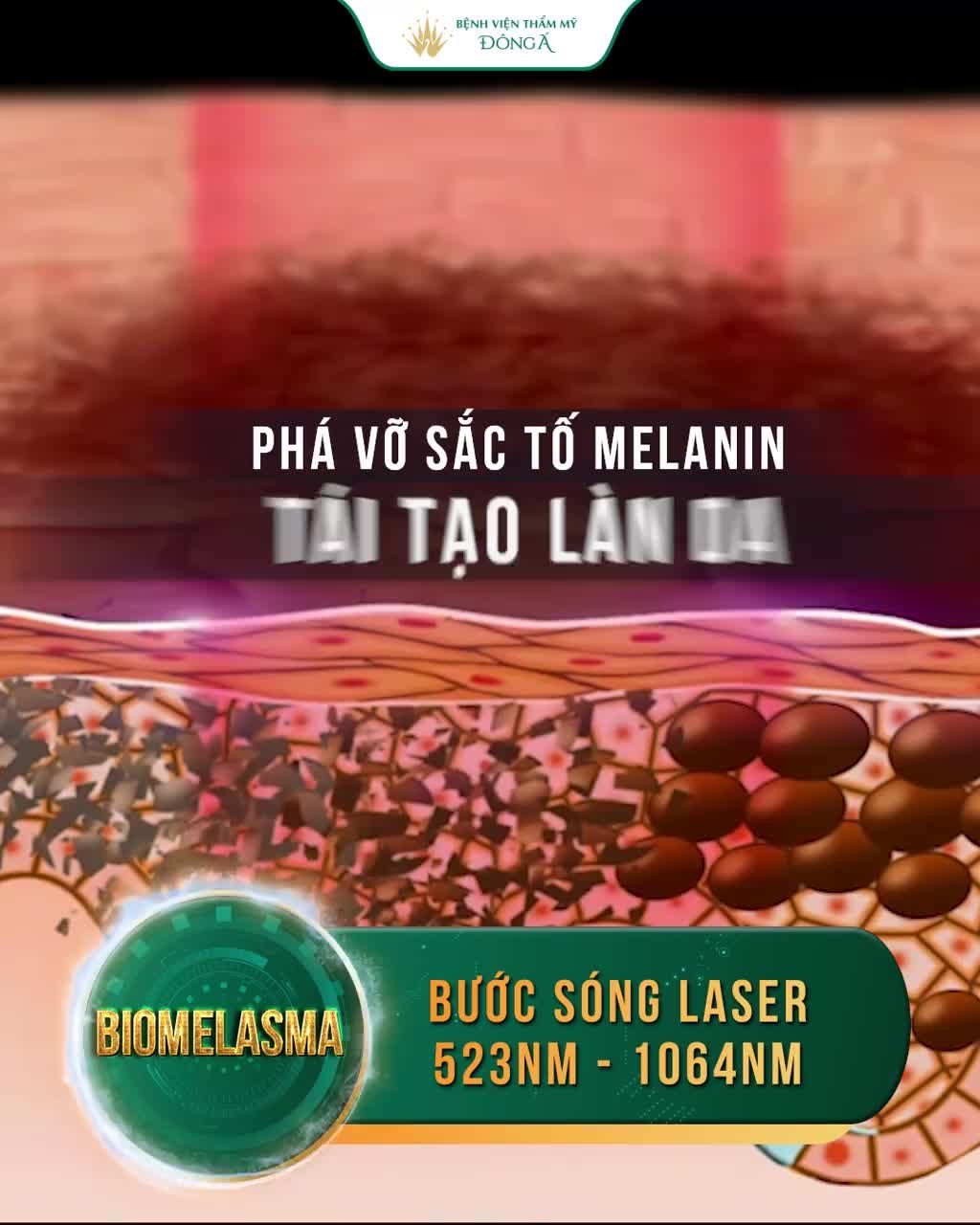 Nám 1 năm hay 30 năm đều trị dứt điểm  Siêu phẩm TRỊ NÁM 3 tác động: Sạch nám - Sáng da - Trẻ hóa