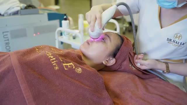 Trị tàn nhang 1 lần duy nhất bằng Công nghệ Laser Spectra – elos "Đánh bay" những đốm tàn nhang "đáng ghét"
