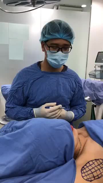 Qui trình chiếu ánh sáng laser trong hút tuyến nội soi Endo Dry