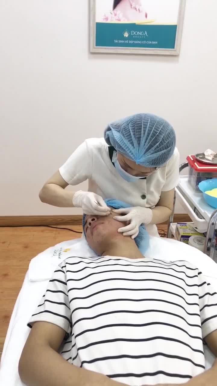 Qúa trình tìm lại vẻ đẹp trai cho khách hàng.