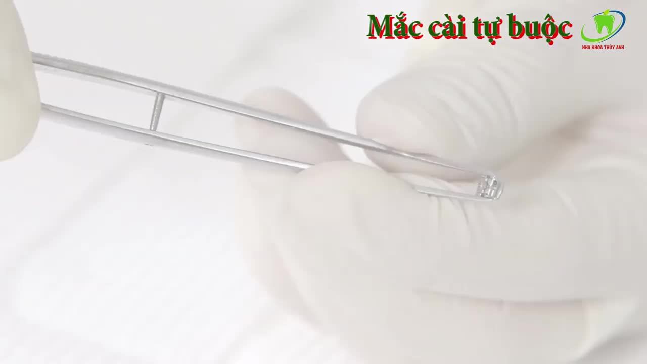 MẮC CÀI TỰ BUỘC THÔNG MINH LÀ GÌ