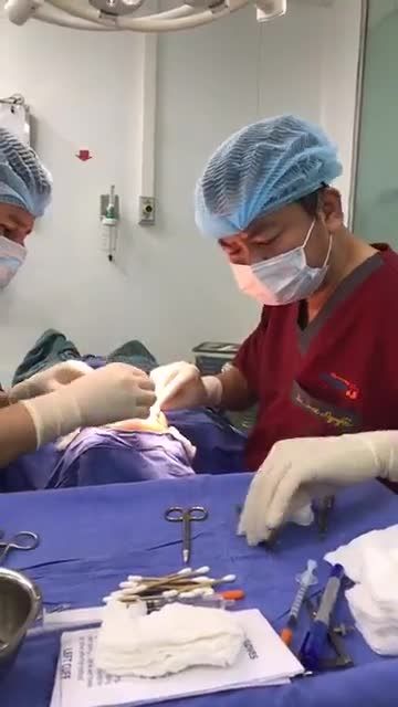 Qui trình Bấm mí- tạo nếp mí tự nhiên ngay sau làm tại bệnh viện Thẩm mỹ Kangnam