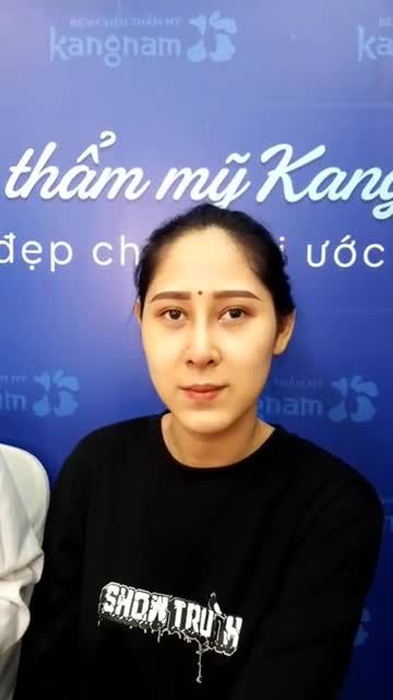 KHÁCH HÀNG NÂNG MŨI SLINE 4D SIÊU ÂM