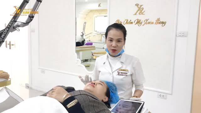 CHỈ 1 BUỔI LÀ ĐÃ TRỊ SẠCH TÀN NHANG, NỮ KHÁCH HÀNG CHIA SẺ