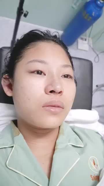 TIẾP TỤC CA NÂNG MŨI CẤU TRÚC VỪA ĐƯỢC DR.HOẠT THỰC HIỆN XONG