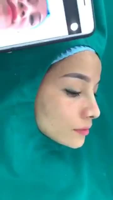 Dáng mũi hot nhất mọi thời đại đây các chị em ơi