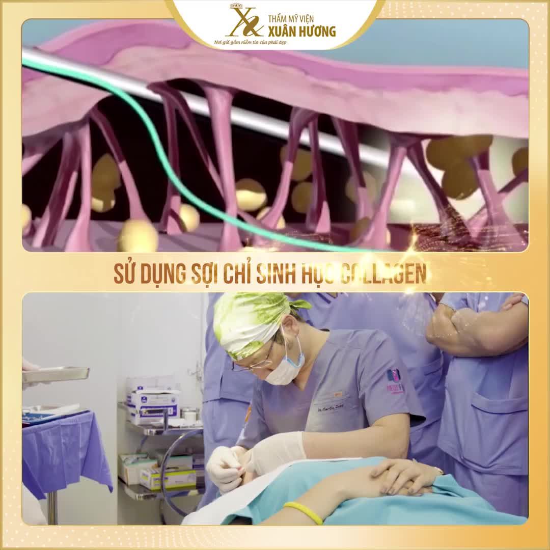 XÓA TAN MỌI DẤU HIỆU LÃO HÓA - NÂNG CƠ TRẺ HÓA TOÀN DIỆN