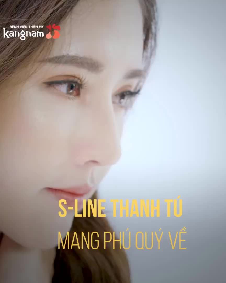 Đón Tết với MŨI CAO SANG  Chọn dáng S-line thanh tú hay L-line cao tây