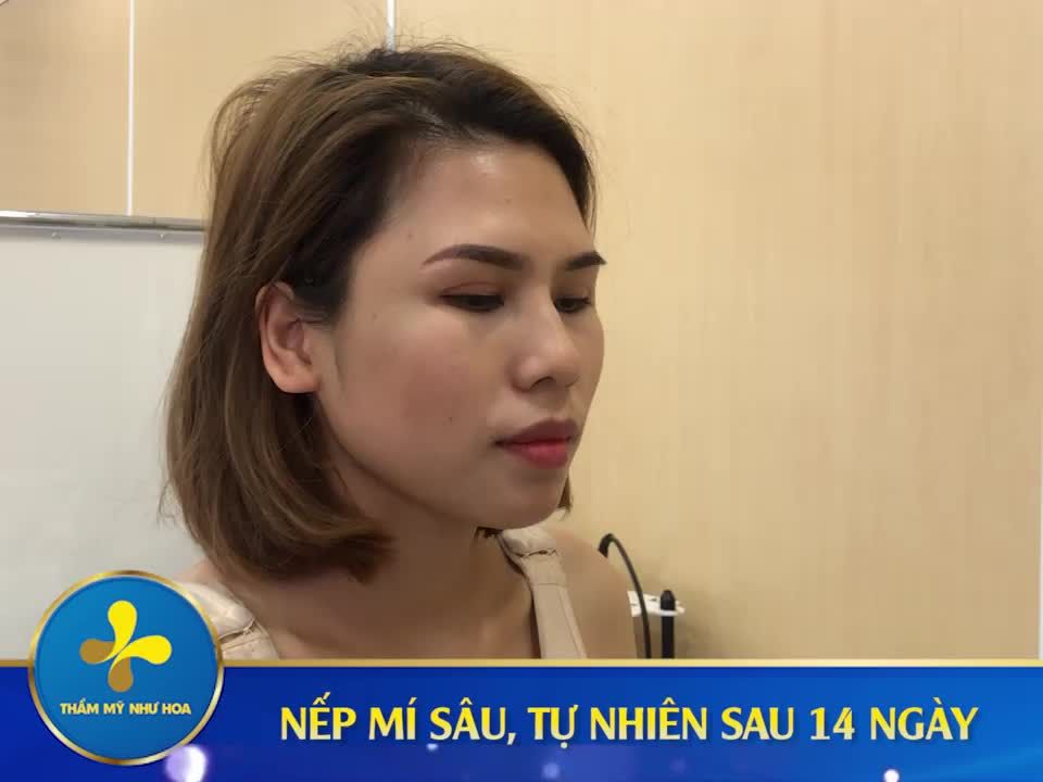 TÚT LẠI ĐÔI MẮT ĐẸP VỚI CẮT MÍ GOLDEN EYES