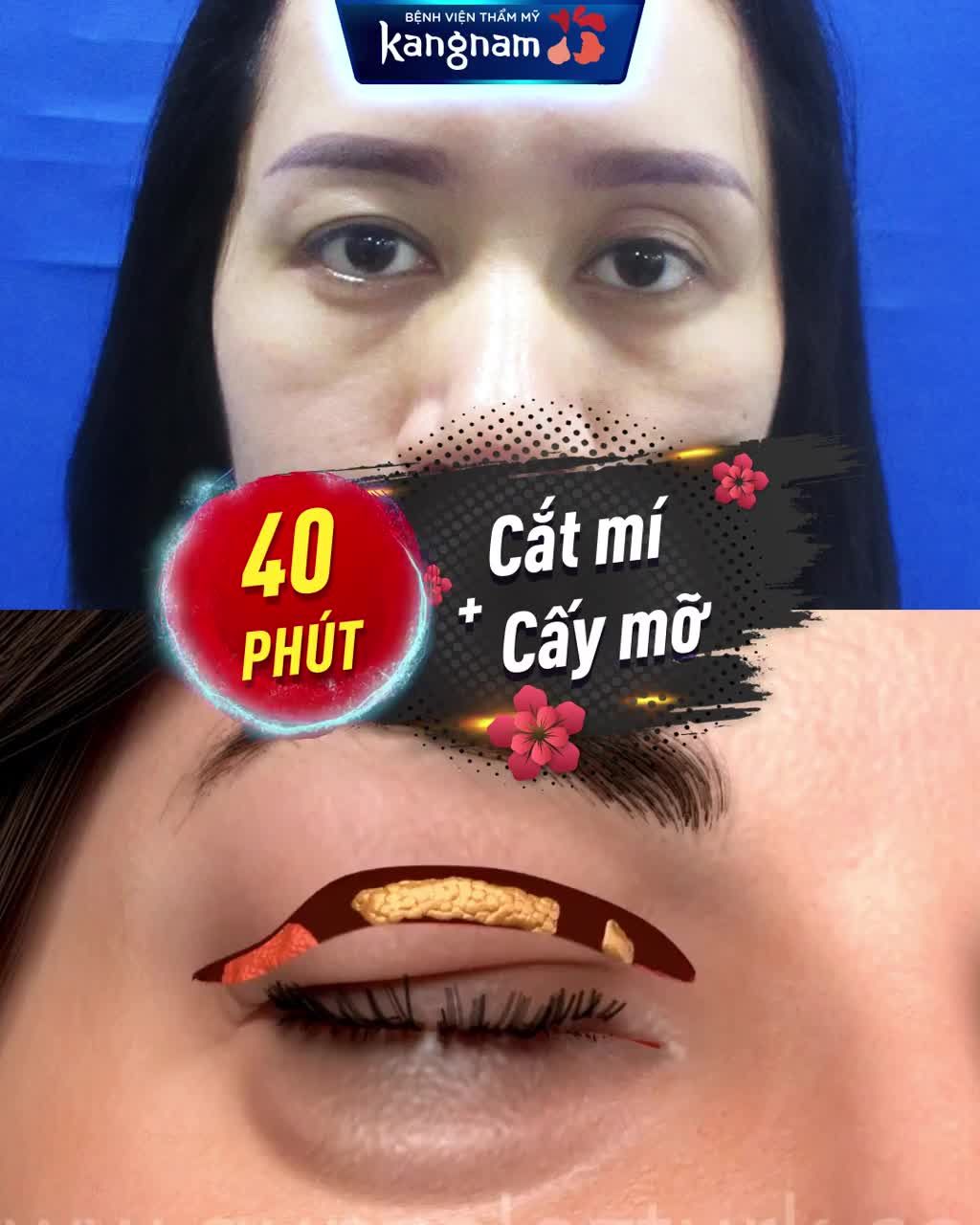 Hồi Xuân MẮT LÃO HÓA - Chỉ 30 Phút  Trẻ trung ĐÓN TẾT