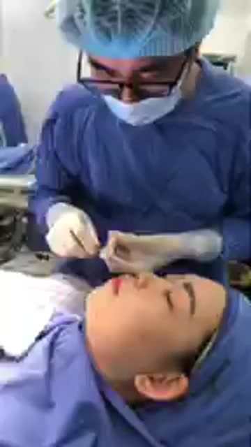 Phân tích, tạo hình chất liệu ca Nâng mũi Cấu trúc 4D tại Bệnh viện Thẩm Mỹ Kangnam