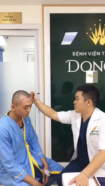19 TUỔI đã HÓI NẶNG  Vị khách hàng chọn CẤY TÓC TỰ THÂN Biohair Transplant!