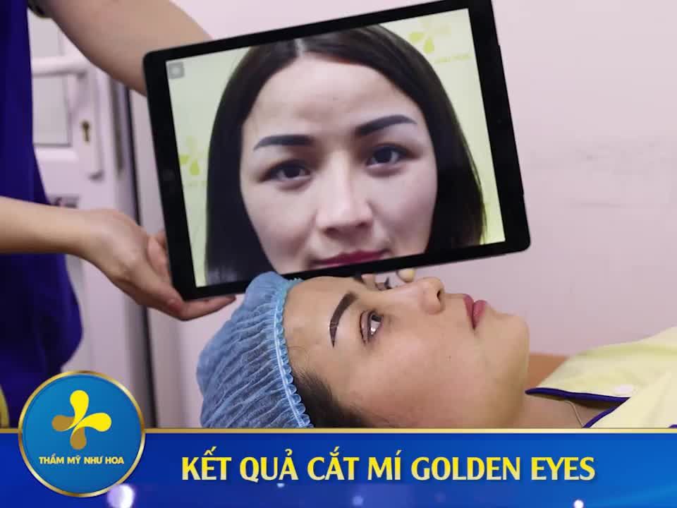 MẮT 2 MÍ TƯƠI TRẺ CHỈ CẦN 30 PHÚT