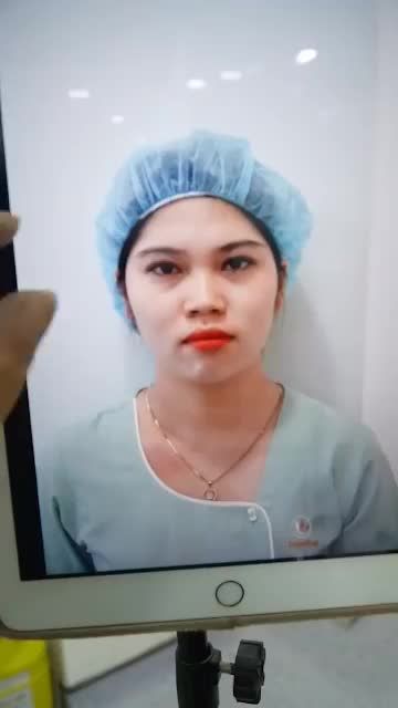 MŨI CẤU TRÚC VỪA THỰC HIỆN XONG - MŨI ĐẸP CAO THON
