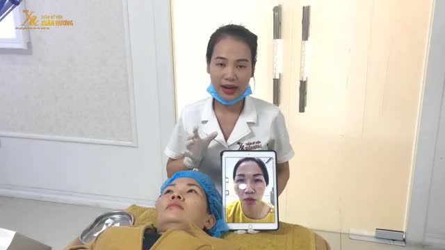 DA TỔN THƯƠNG SAU ĐIỀU TRỊ BẰNG LASER KHÔNG RÕ NGUỒN GỐC️MỜ TỚI 99% SAU 3 BUỔI ĐIỀU TRỊ NEW PASTELLE