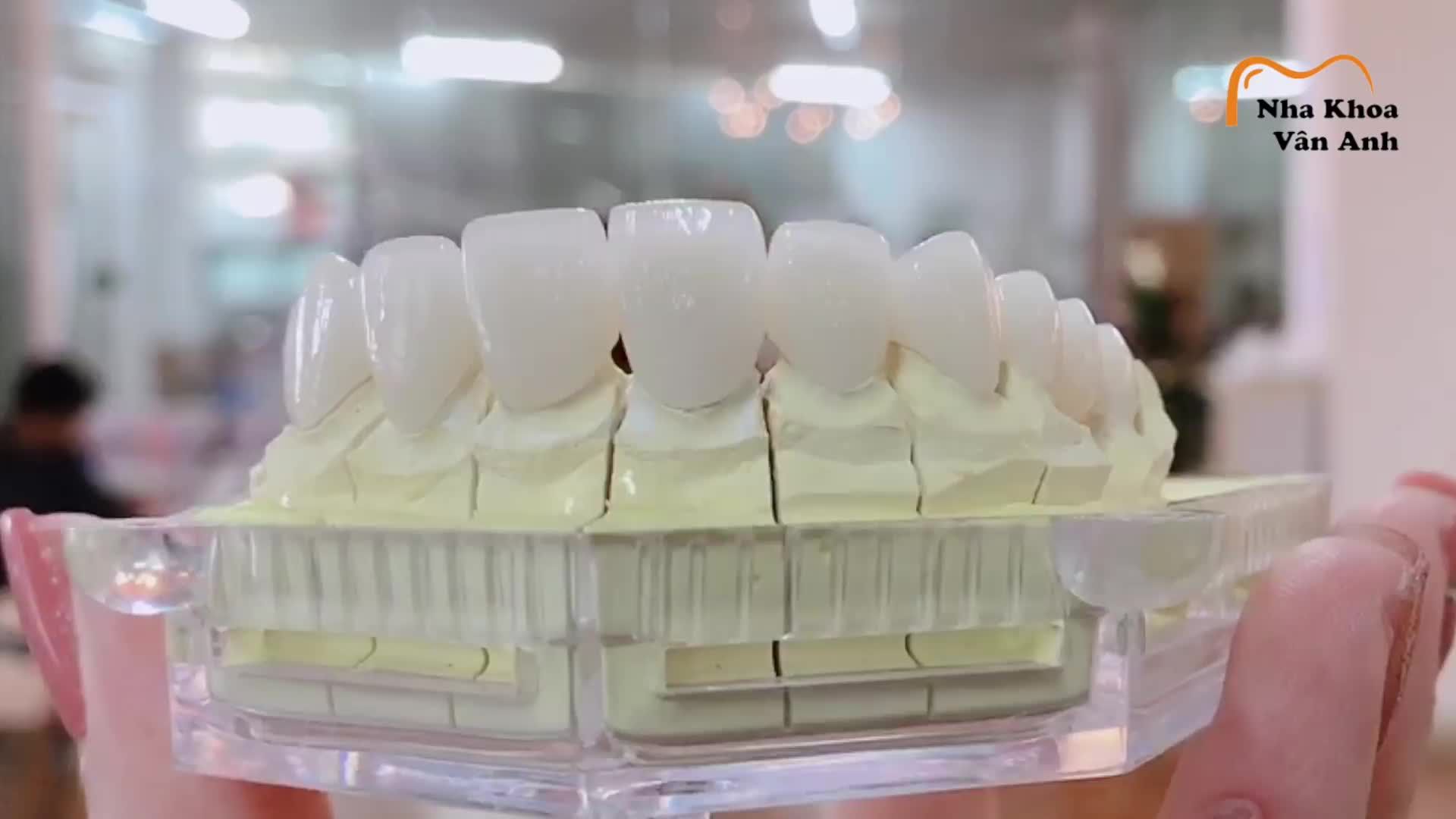 ĐỪNG ĐỂ HÀM RĂNG XẤU, NỤ CƯỜI THIẾU TỰ TIN CẢN BƯỚC BẠN TỚI THÀNH CÔNG !