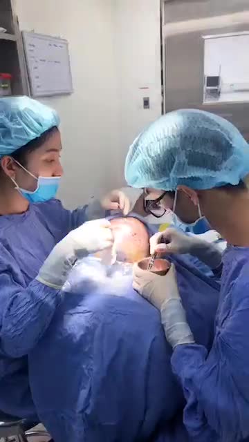 Cấy tóc gần 6 Tiếng đồng hồ Kết quả mang lại cho khách hàng quá kinh ngạc .