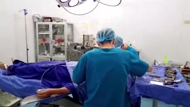 Cận cảnh nâng mũi SOFTLINE do Dr Vũ Quang thực hiện cho chị khách hàng đến từ Hưng Yên.