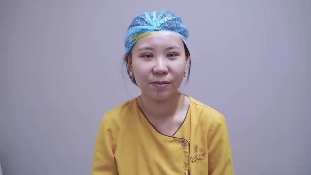 Khách hàng đến từ Trung Quốc sở hữu nếp mí đẹp hoàn hảo nhờ công nghệ cắt mí Double Deep 5D của VTM Dr.Hải Lê.