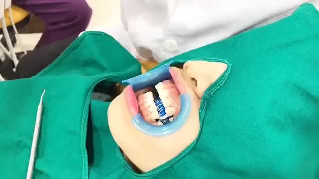 Case Chỉnh nha tự động và cùng nghe chia sẻ của Bác sĩ