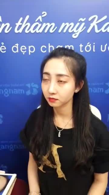 KHÁCH HÀNG NÂNG MŨI SLINE 4D