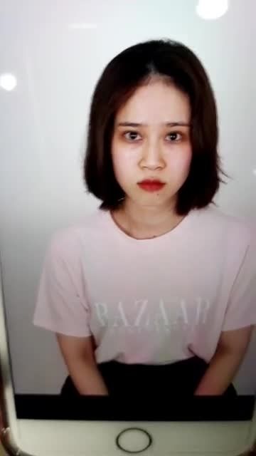 Mời mọi người tham khảo qua dáng mũi cấu trúc sóng surgifom sau 10 ngày phẫu thuật nhé