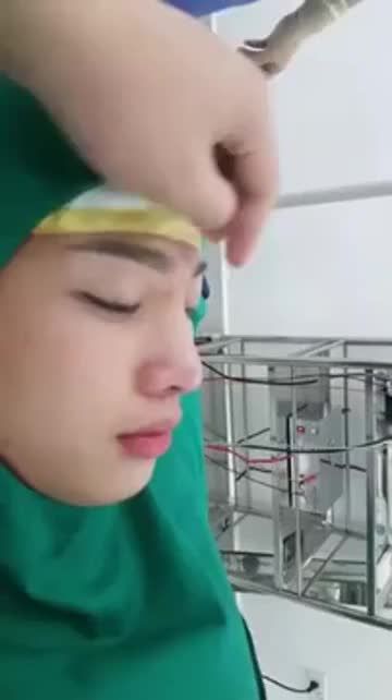 Nâng mũi bán cấu trúc bằng sụn tai