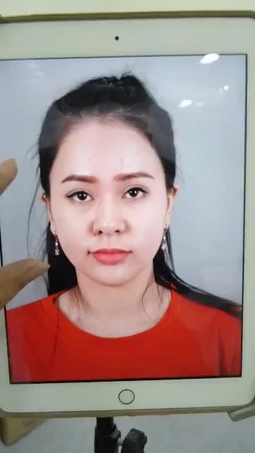 THÀNH CÔNG CỦA CA NÂNG MŨI CẤU TRÚC VỪA THỰC HIỆN XONG