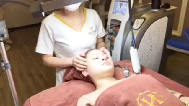 ĐIỀU TRỊ NÁM BUỔI THỨ 5, đã khắc phục được 60% tình trạng nám cũ.