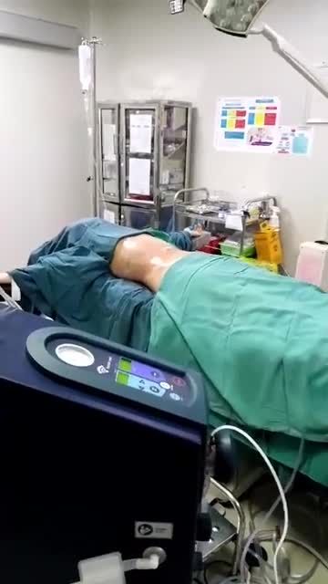 HÚT MỠ BỤNG TẠO CƠ SĂN CHẮC cho khách hàng bằng công nghệ BODY JET số 1 hiện nay