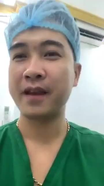 Nâng mũi nạo filler sau 1tuần tiêm tan