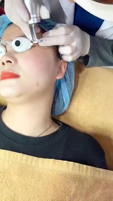Quy trình điều trị “Tàn Nhan” với công nghệ Laser tại BVTM Kangnam