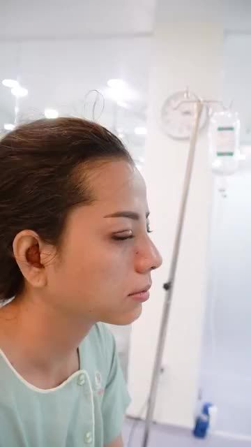 KHÁCH HÀNG VỪA NÂNG MŨI + CẮT MÍ TẠI DR.HOẠT