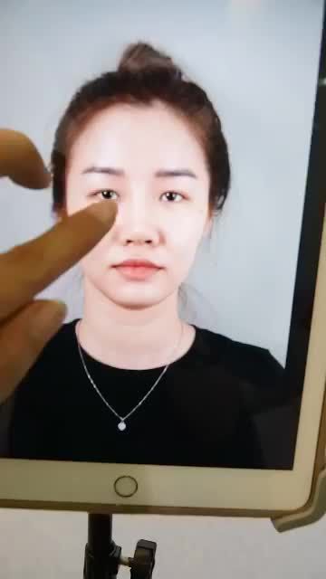 DR.HOẠT XỬ LÝ THÀNH CÔNG CA MŨI HỎNG CHO KHÁCH