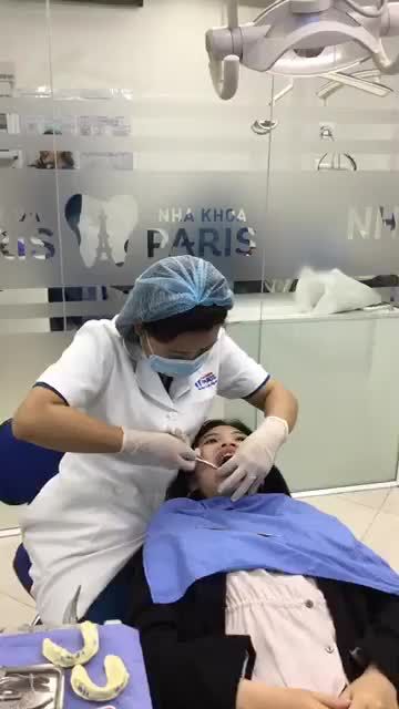 KH chỉnh nha mắc cài sứ tự buộc tại nha khoa Paris Quang Trung.