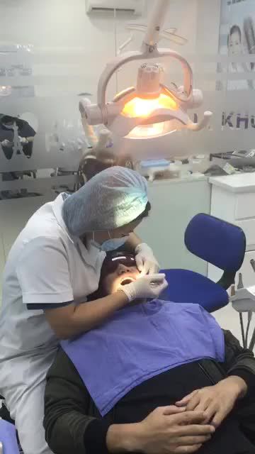 Không còn bận tâm khuyết điểm trước đây, tự tin cười rạng rỡ chỉ sau 6 tháng niềng răng.