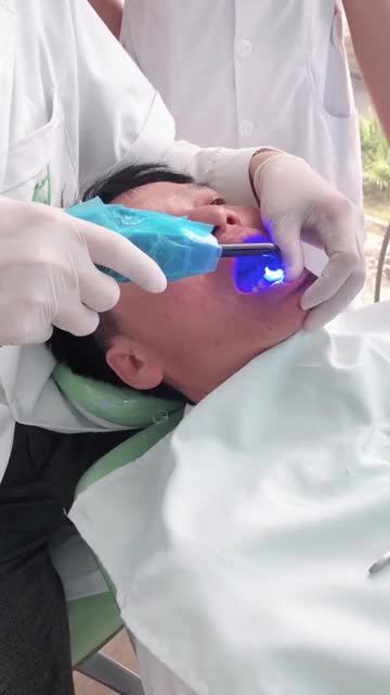 CASE KHÁCH HÀNG PHỦ 16 VENEER - Chú Nguyễn Văn Bảo tại chi nhánh Nguyễn Ngọc Vũ.
