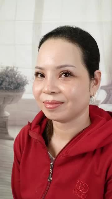 THAY ĐỔI HOÀN HẢO SAU 10 NGÀY NÂNG MŨI + CẮT MÍ MẮT
