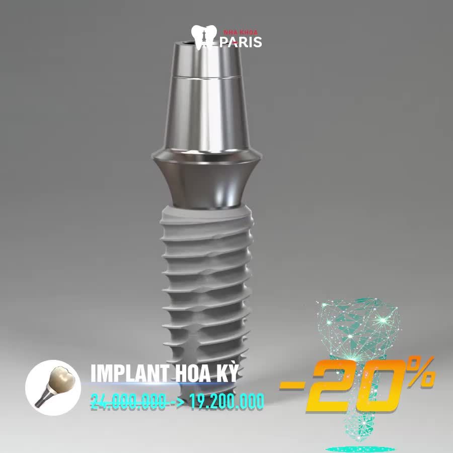 VỀ VIỆT NAM: TRỒNG RĂNG IMPLANT Ở ĐÂU?