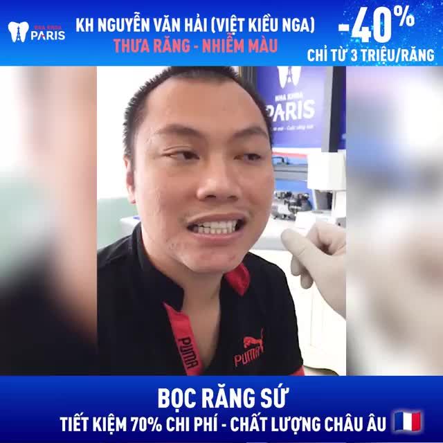 Kết Quả Anh Hải Việt Kiều Nga Bọc Toàn Hàm 20 răng 5S