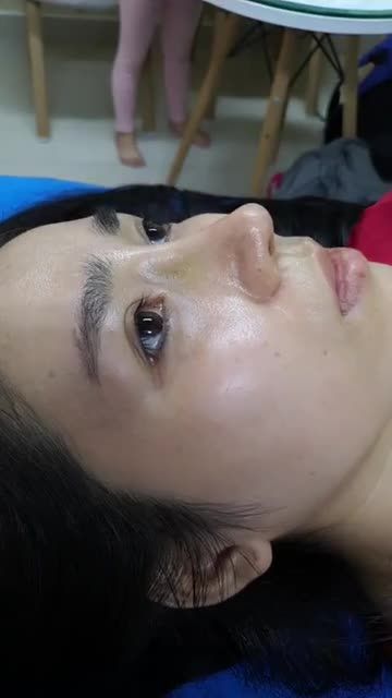 Nâng mũi bán cấu trúc Dáng Lline cao tây Quá đẹp cho em cho em gái Quận 8