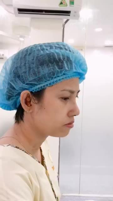 NÂNG MŨI CẤU TRÚC DR.HOẠT - MŨI TINH TẾ TỪNG GÓC NHÌN