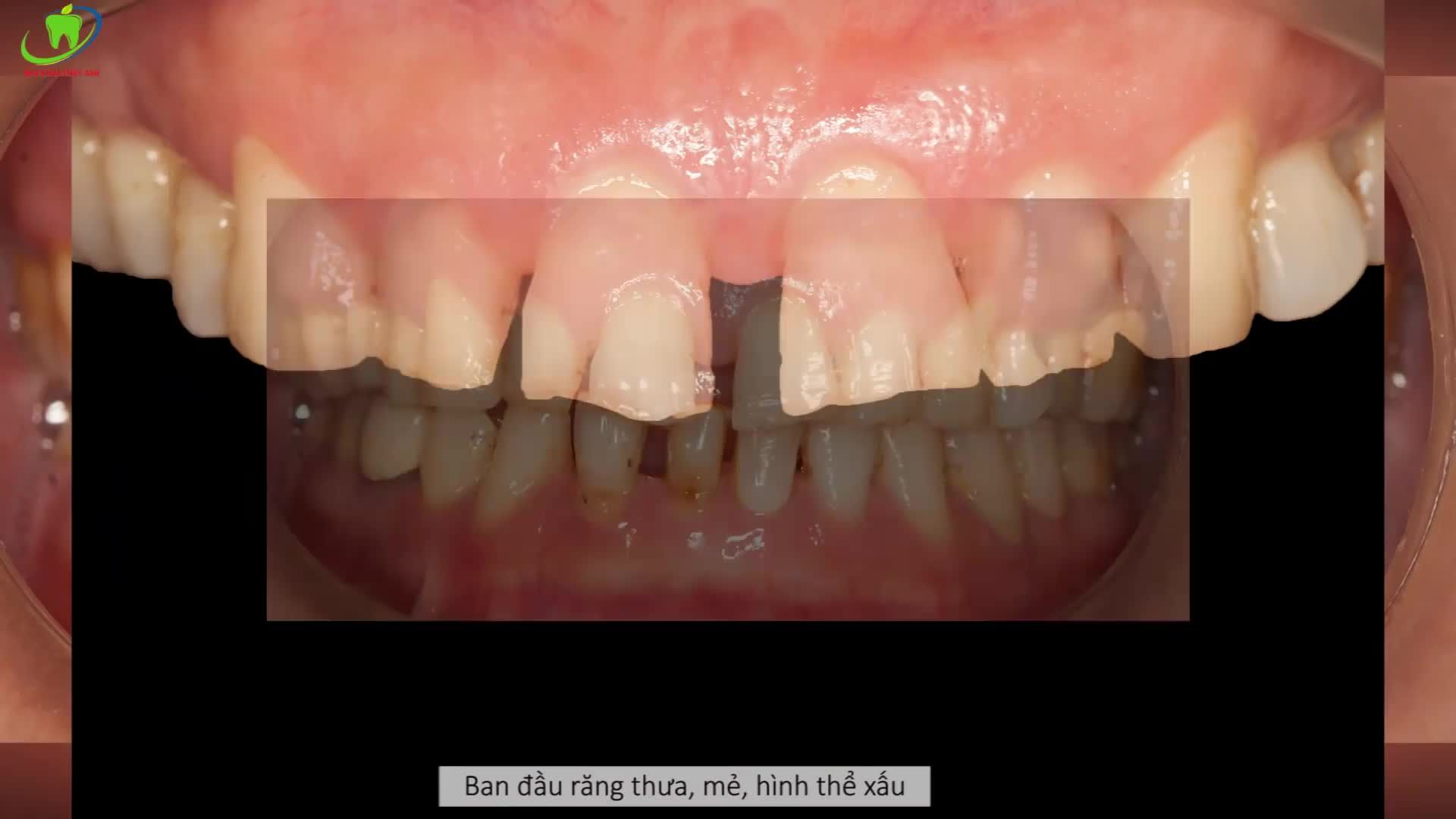 TRAO TRỌN NIỀM TIN ĐÚNG CHUẨN - CẢ ĐỜI KHÔNG LO LẮNG
