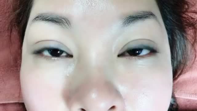Gặp lại bạn gái sau 1 năm cắt mí MANI MINI DEEP 5D tại Dr.Hải Lê!