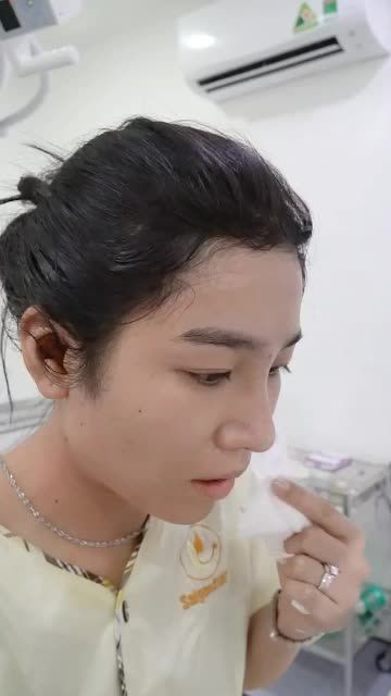 NÂNG MŨI CẤU TRÚC SỬA LẠI TẠI DR.HOẠT - TÁI TẠO DÁNG MŨI MỚI ĐẸP TỰ NHIÊN NHƯ MỚI NÂNG LẦN ĐẦU